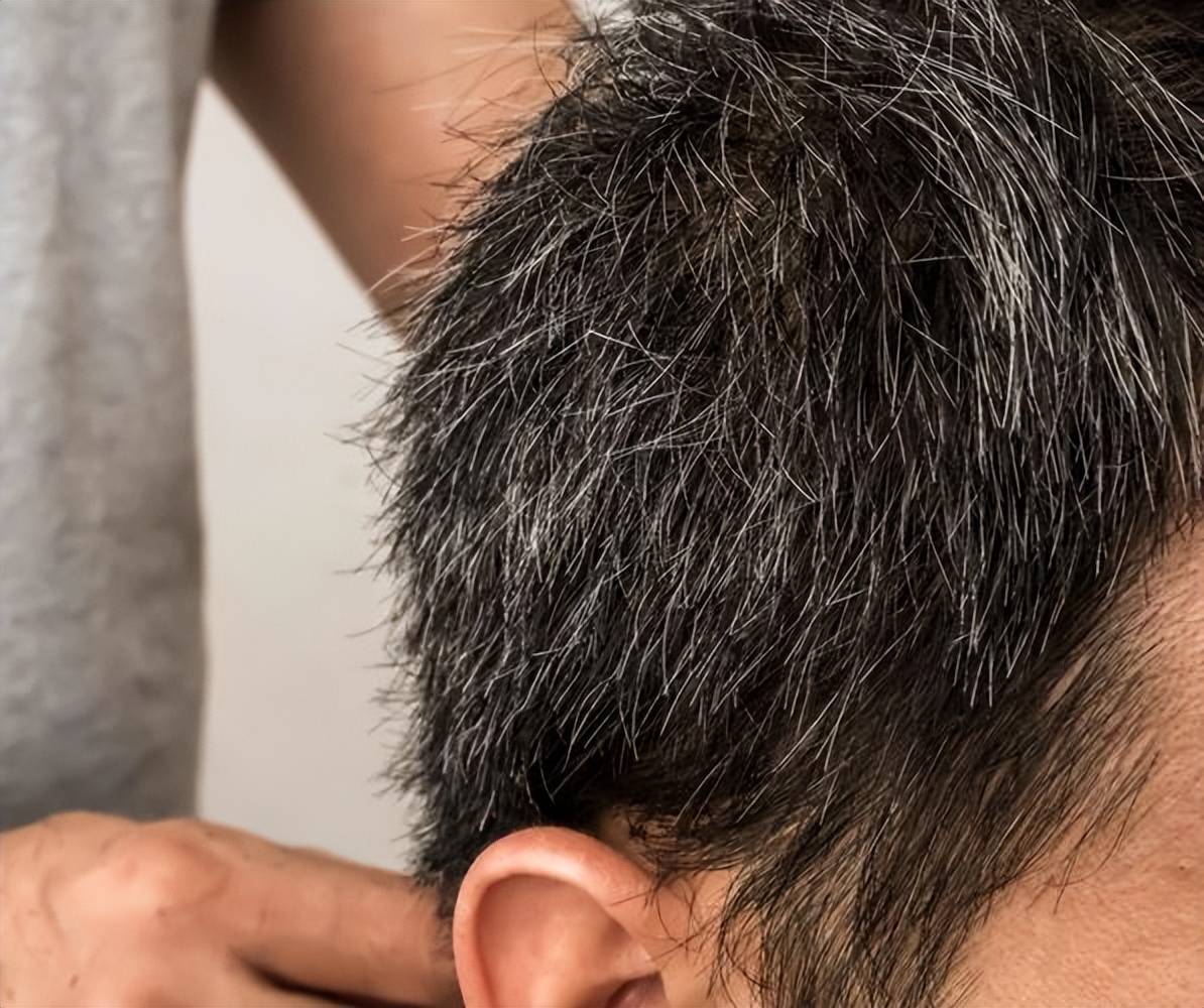世界美发日：要想降低对人体的伤害,染发之前,需得做好5件事