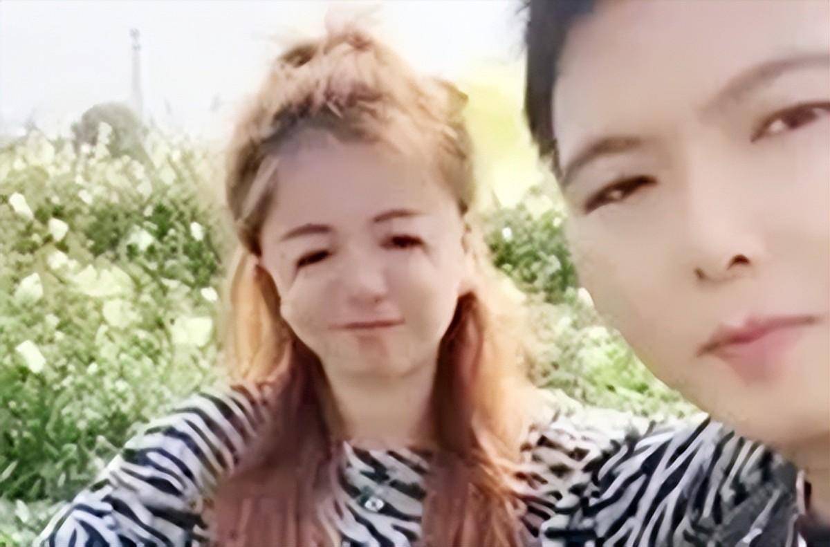 鸟面综合症发病率为1/50000,有50%几率会遗传给下一代.