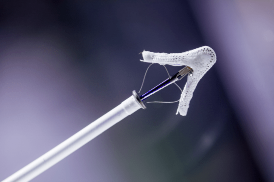 中国的雅培amplatzer piccolo64动脉导管未闭封堵器迎来中国首发