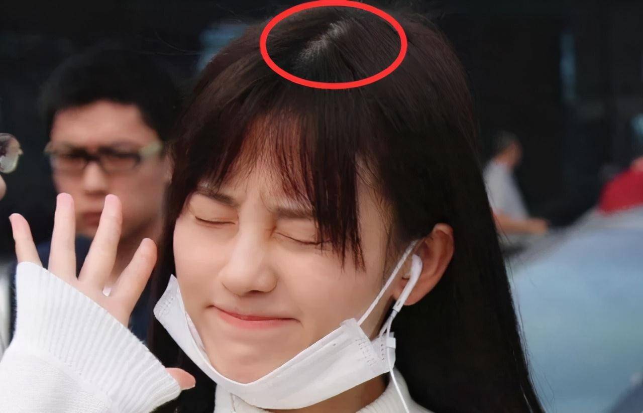 女星为了发际线有多拼?