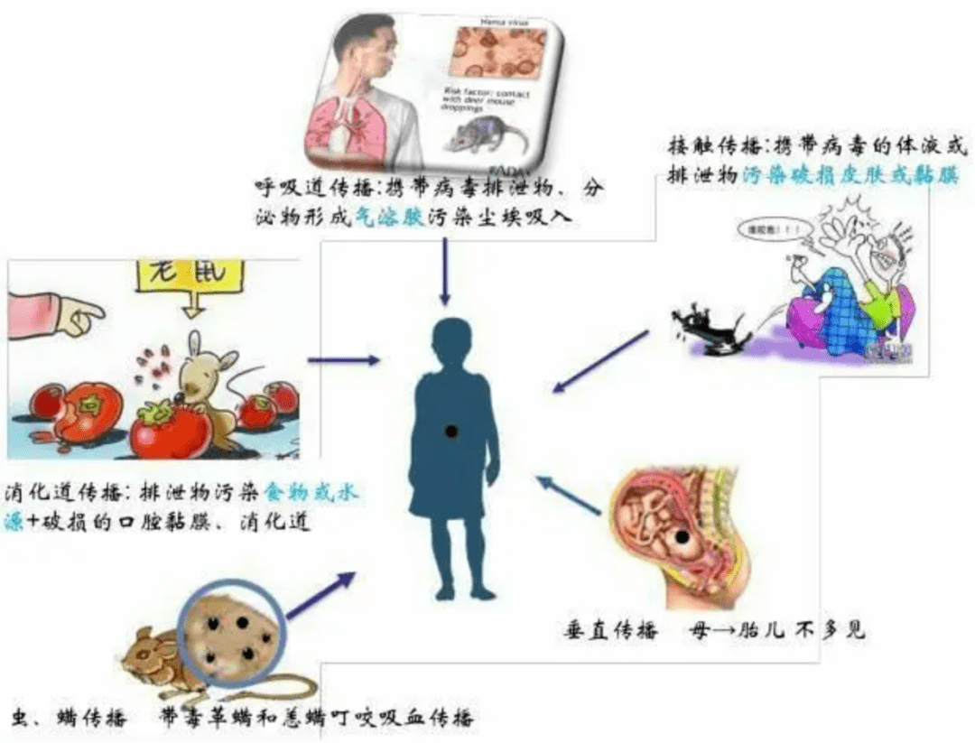 出血热临床症状有哪些如何传播的(如何有效预防)