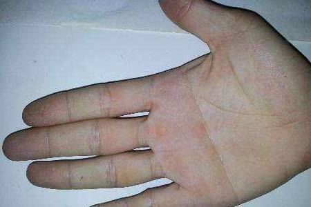 死亡前掌纹的秘密：太平间记录的惊人异象，揭示了生命终结的预兆？