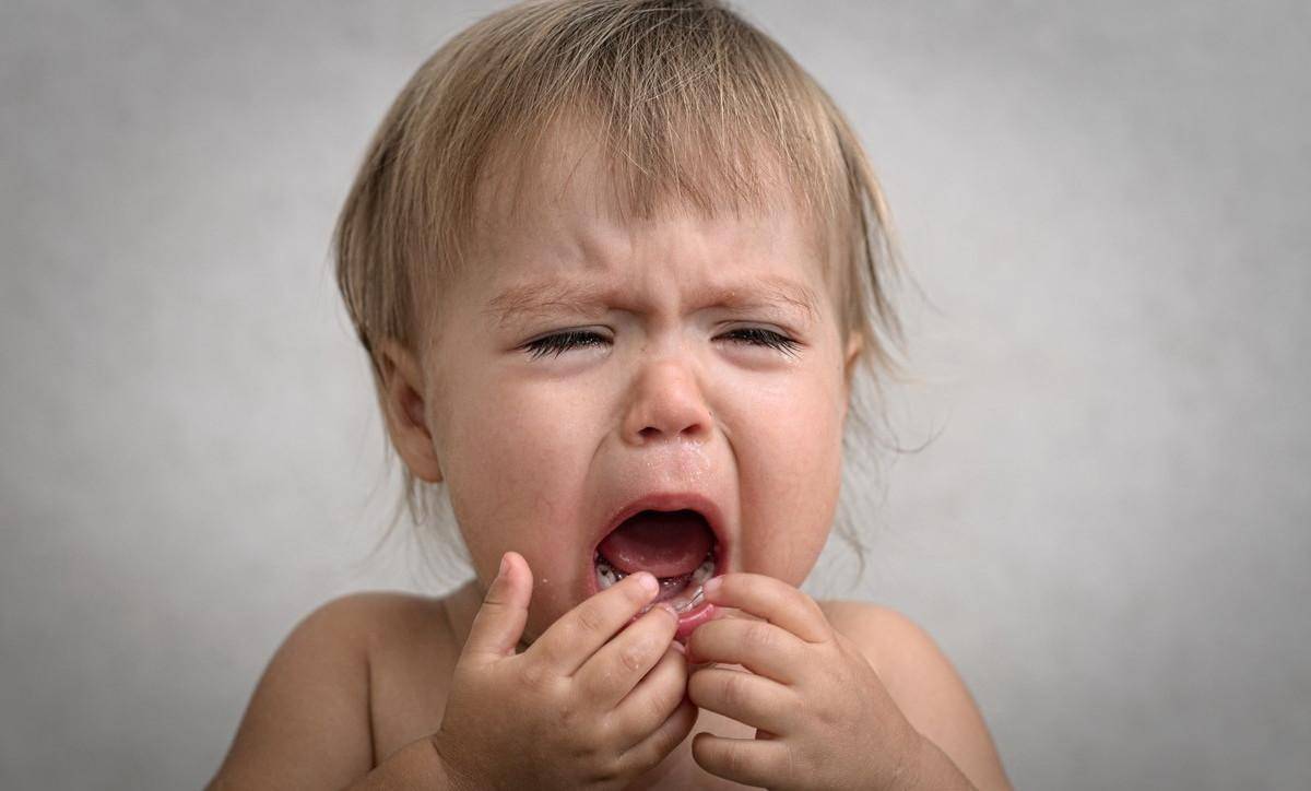 孩子烂嘴角是什么原因引起的(如何预防)