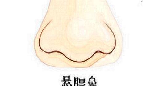 山根略窄,活像一个悬吊着的"猪胆"一样,因此也有人叫这种鼻子"猪胆鼻"