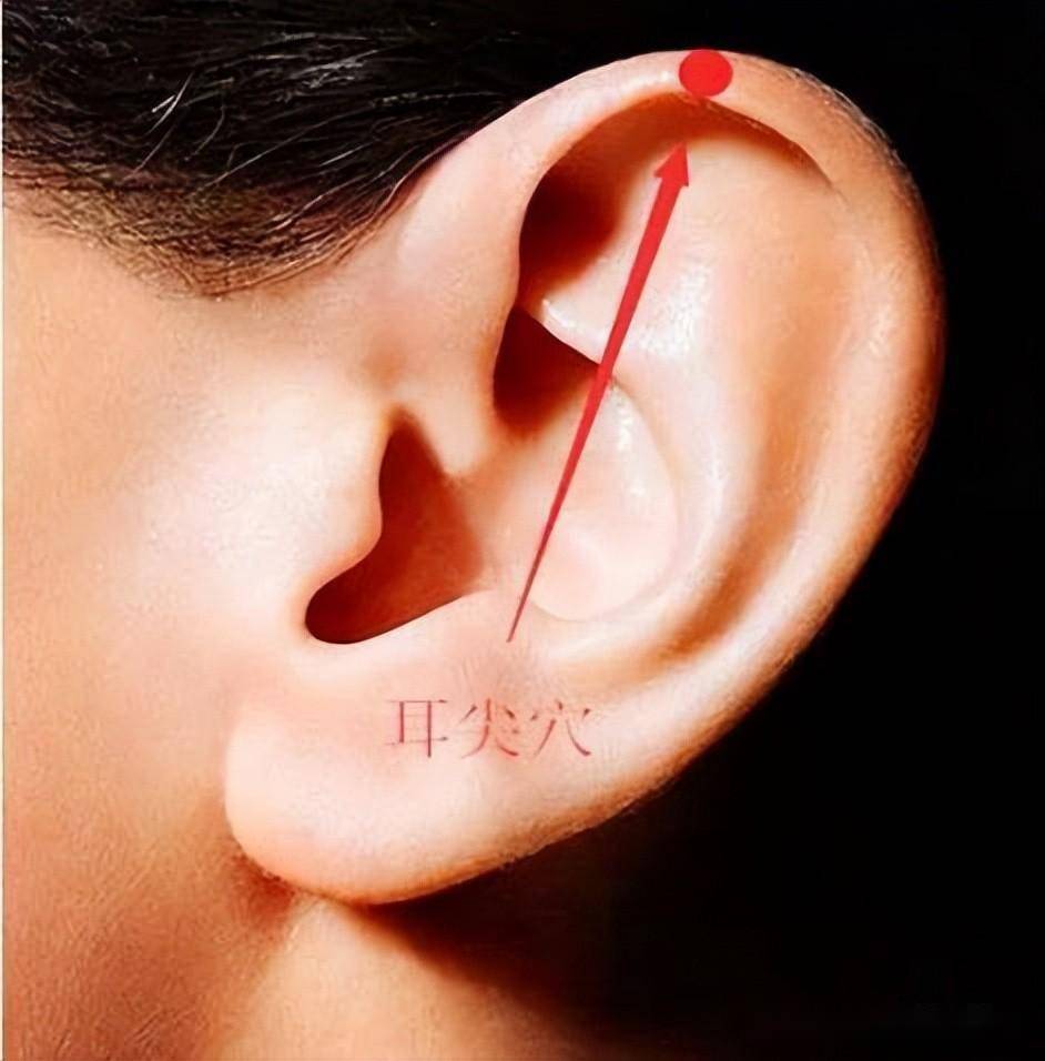 耳垂放血的位置图片图片