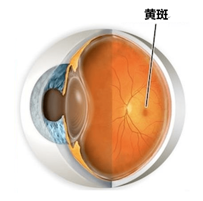 【警惕】什么是老年性黄斑变性?怎么预防?_视力_视网膜_年龄