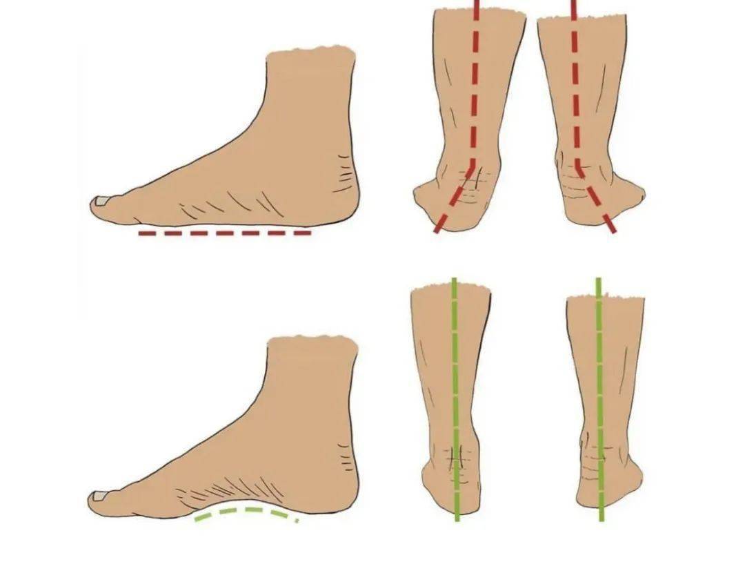 三分钟小课堂:足弓训练(一)