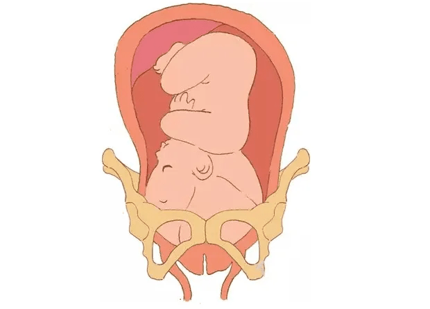 自由体位自由体位的好处:缓解腰骶部疼痛,促进子宫收缩,减轻宫颈水肿