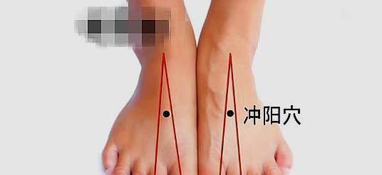 可以睡前贴敷.如果你会艾灸,可以悬灸冲阳穴,左右穴各10分钟.