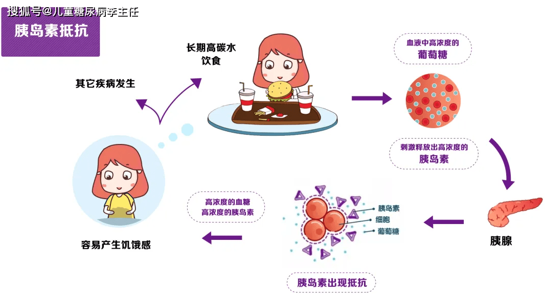 胰岛素的分泌过程图图片