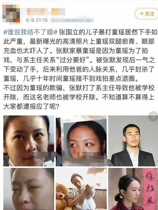 究其原因是微博上铺天盖地的传出张默打童瑶的照片,事件被翻出后