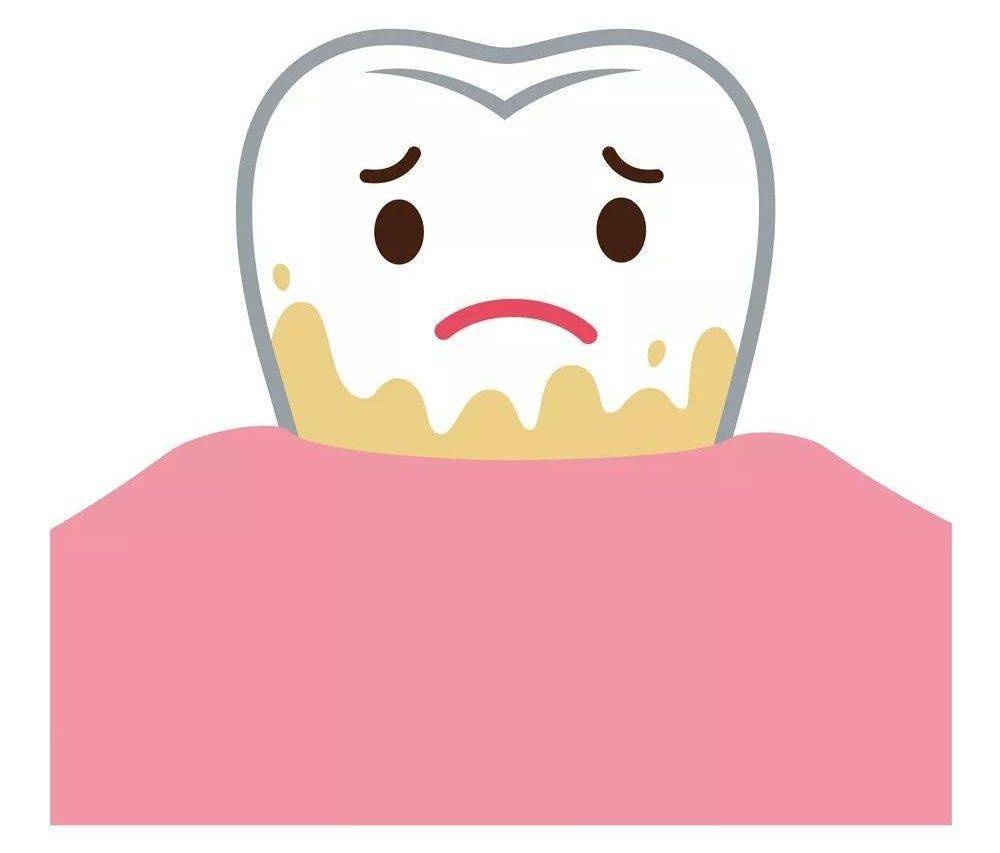 西安圣贝科普 | 居家隔离中遇到牙龈出血怎么办?_菌斑_局部_牙齿