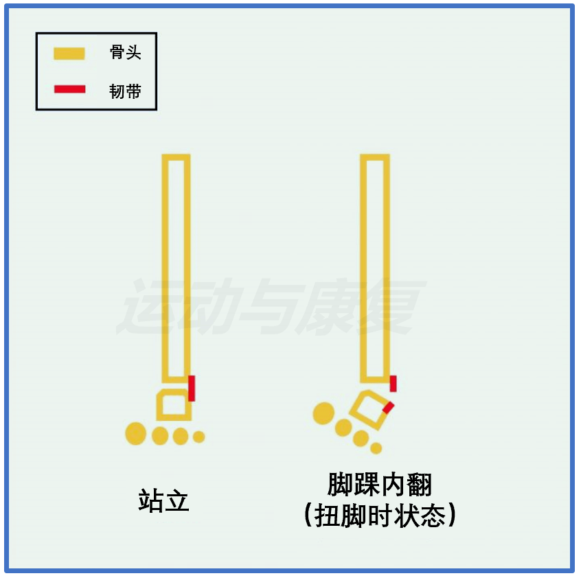 一,什么是脚踝扭伤(ankle sprain?