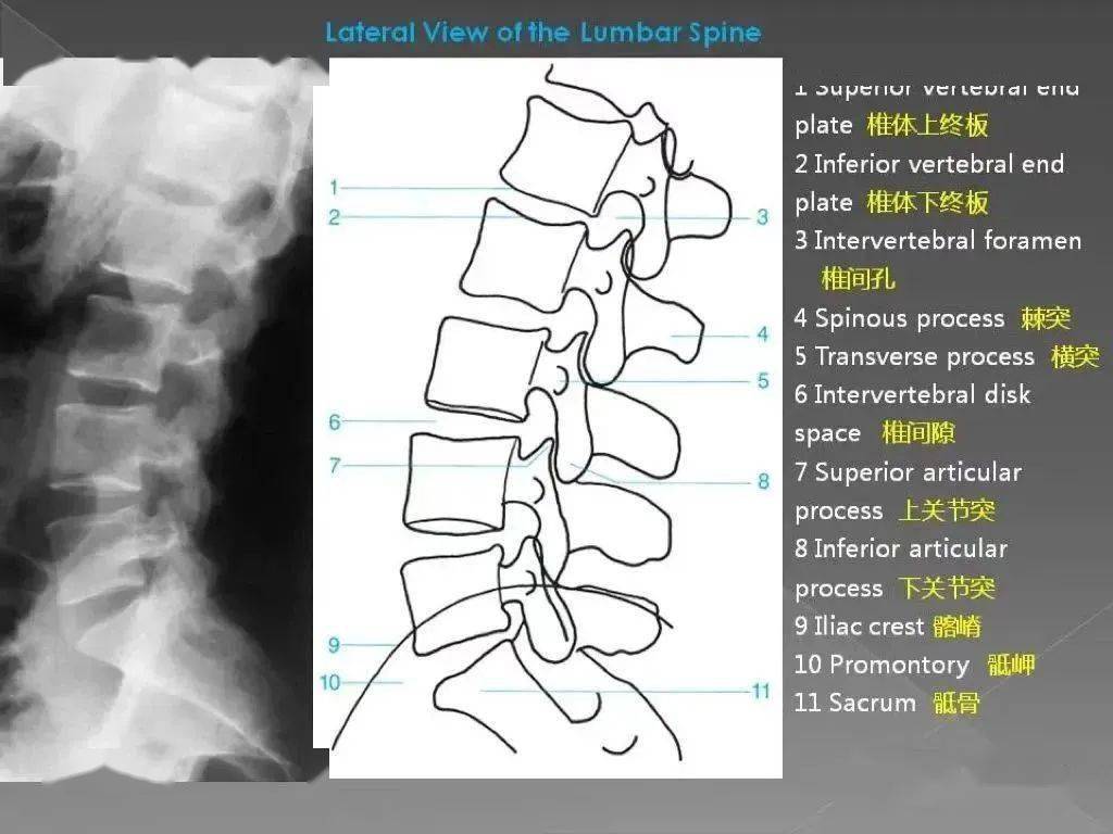腰椎的x线解剖及解读_椎间盘_关节_椎间隙