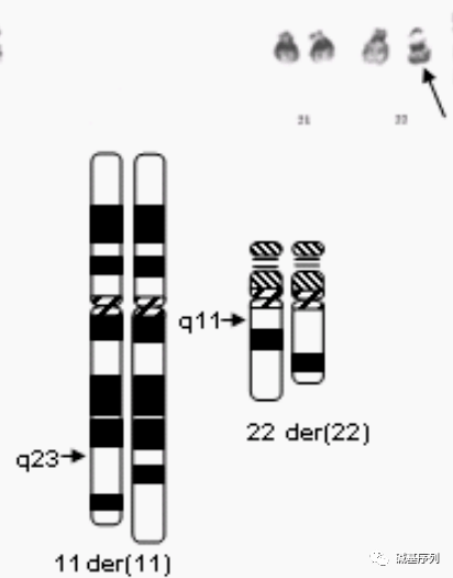 染色体结构变异易位图片