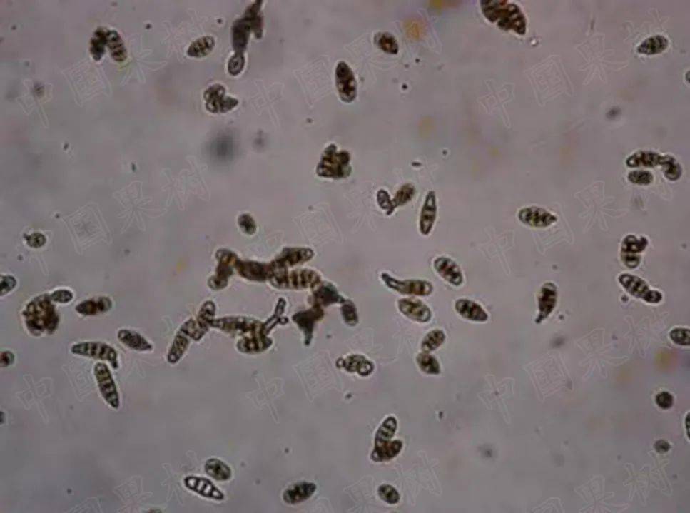 黑斑病菌落及孢子形态特征病原菌为链格孢,属于半知菌亚门丝孢纲丝梗