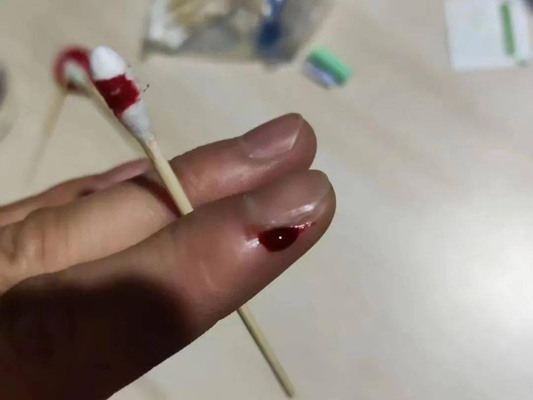 【杏林之声】新冠症状掐按,刺络放血专辑_穴位_定位_进行