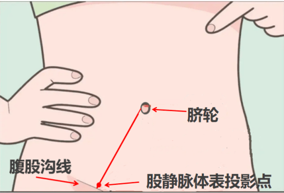 掌握这个采血方法，还担心不能一针见血？