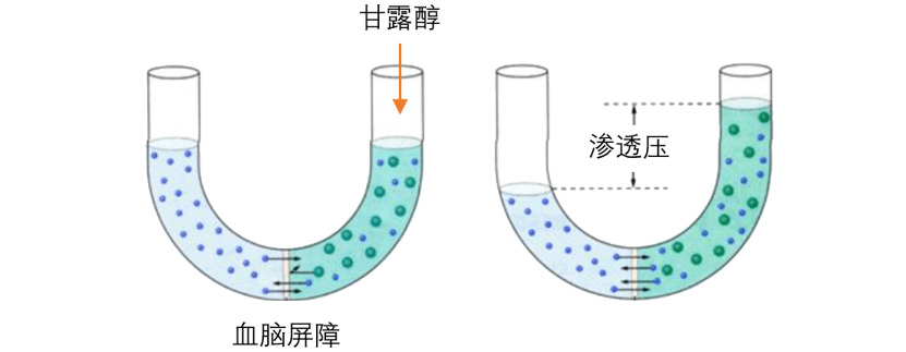 升高,促使水分从脑,眼等周围组织转移到血液中,从而减少脑脊液容量