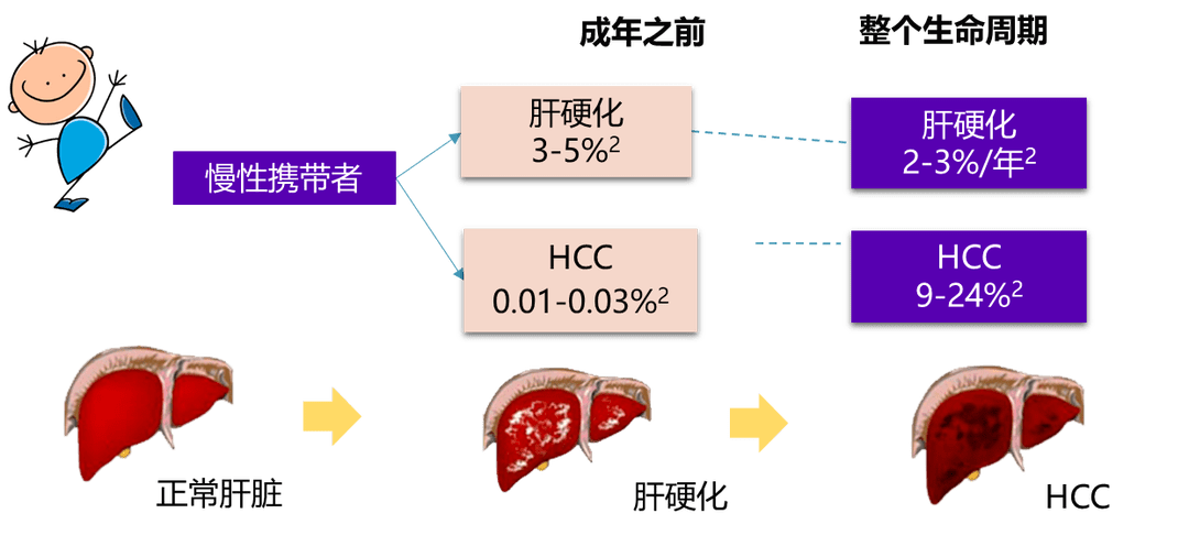 肝硬化分级 来自搜狐网