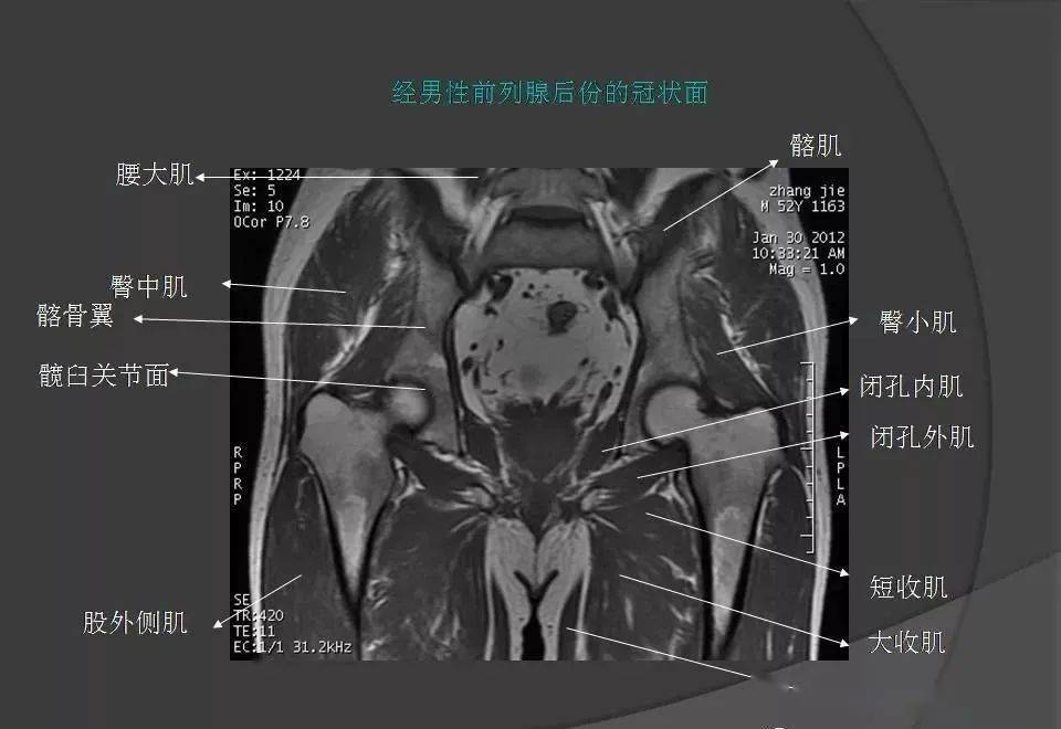 盆腔mri斷層解剖,你學會了嗎?_影像診斷中心_微信_華夏