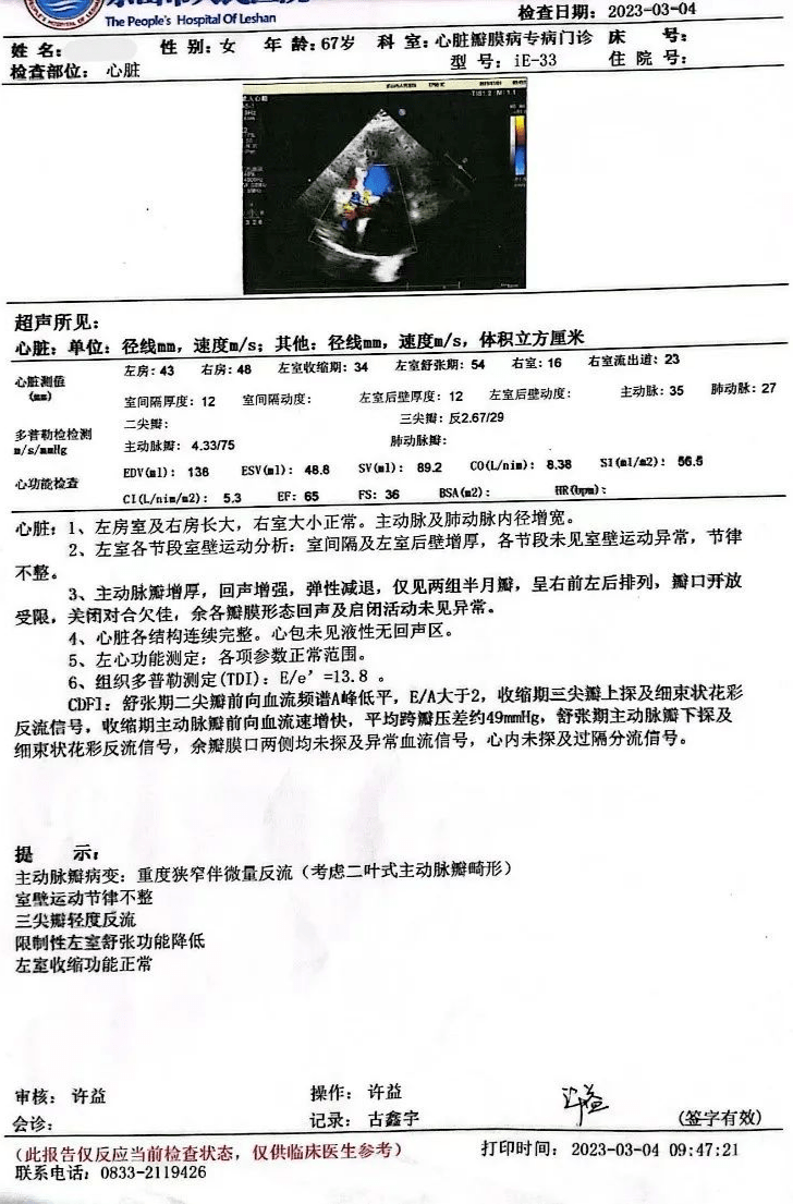 心脏扩大,心功能iii-iv级(nyha分级),急性心力衰竭,心脏瓣膜病
