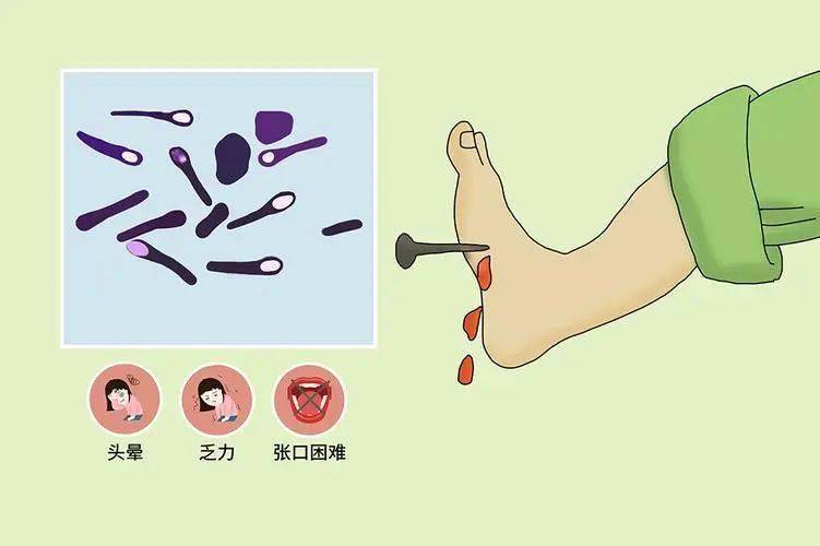 由於破傷風桿菌分佈廣泛,在土壤,空氣及水中普遍存在,且人類普遍對