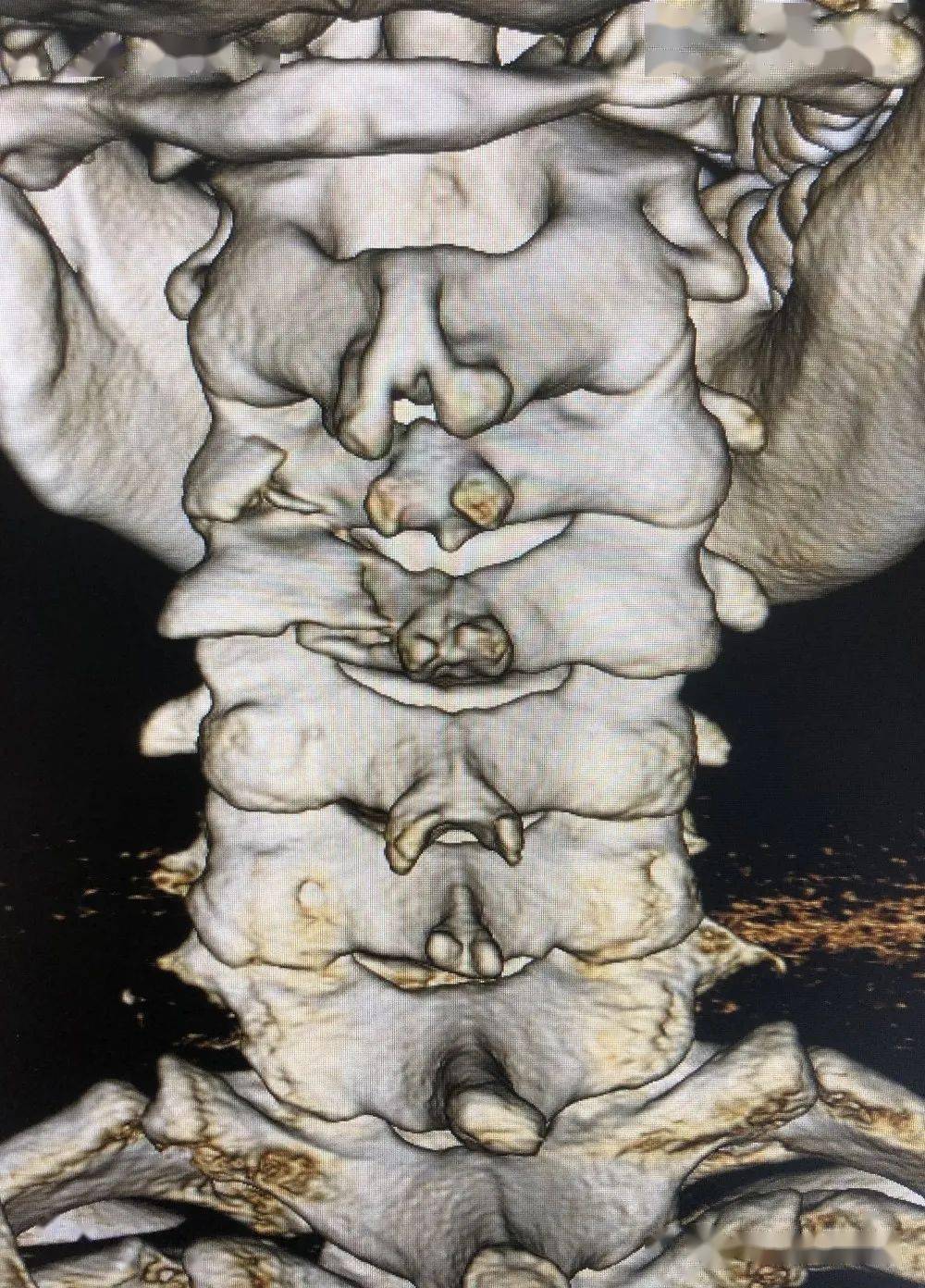 结合患者的病情