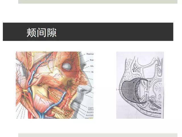 口腔頜面部間隙感染[多圖]_平臺_科普網_尋找