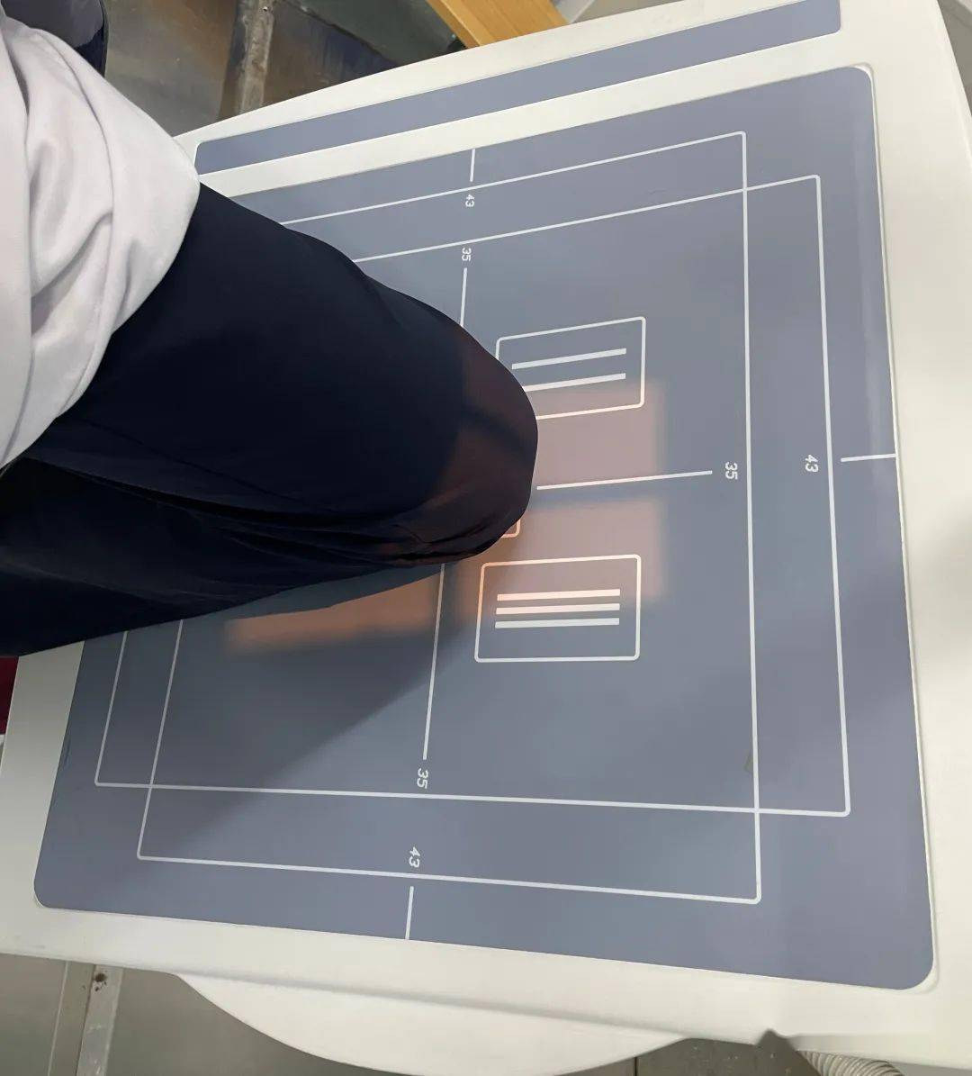 髌骨轴位照样拍!_患者_典型_膝关节