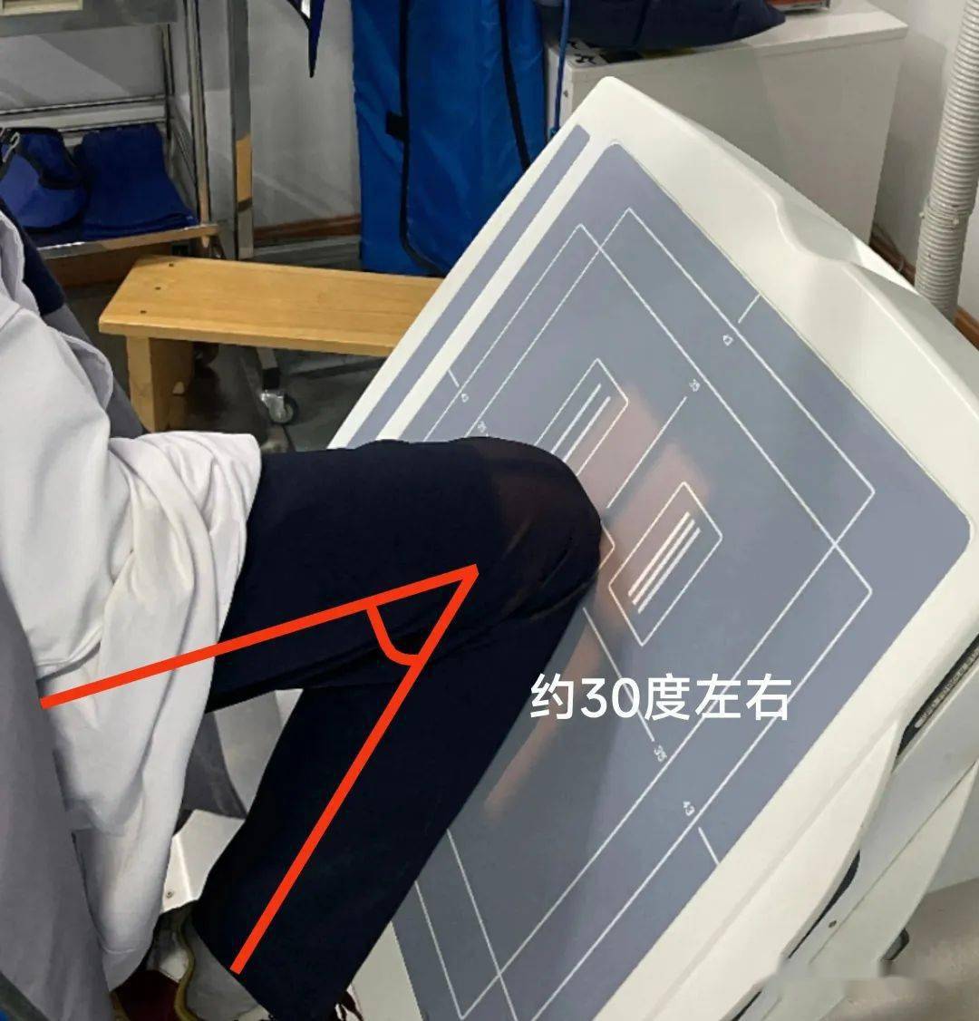 髌骨轴位照样拍!_患者_典型_膝关节