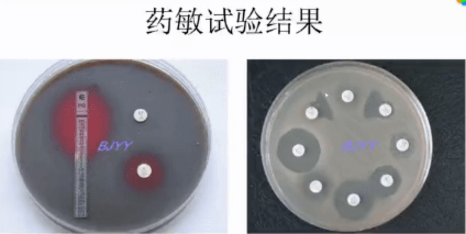 陈东科：做微生物查验，用好摄影手艺很重要