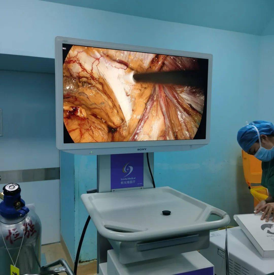 【新技术】首例腹腔镜完全腹膜外疝修补手术(tep)和经腹膜前疝修补术