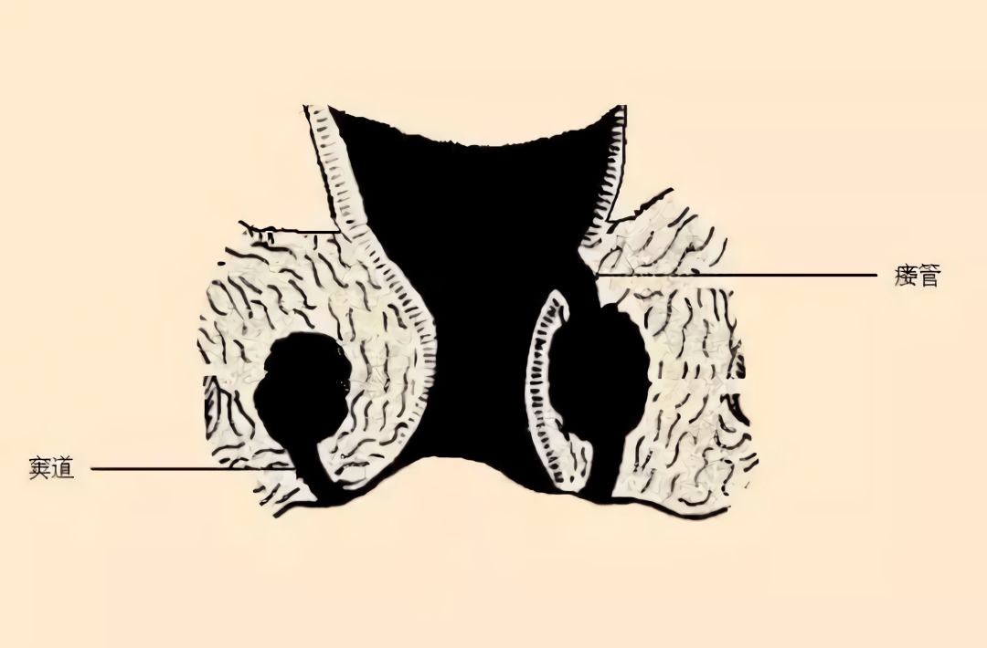 肛周硬块图片