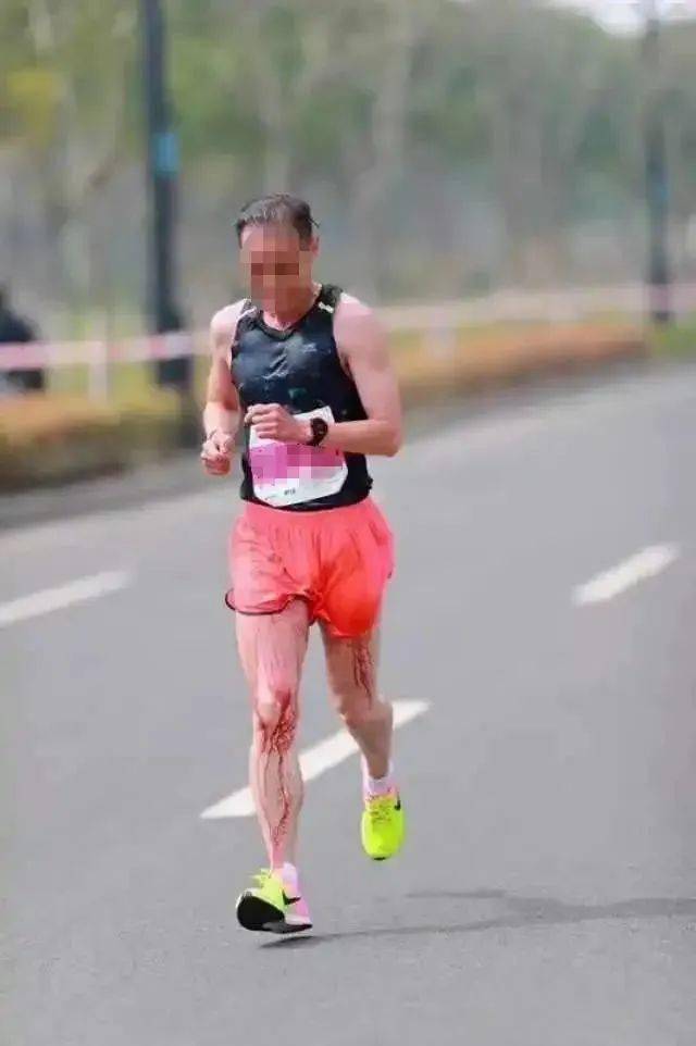 男子跑马磨裆流血染红!原来男人比女人更容易受伤?_比赛_马拉松_男性
