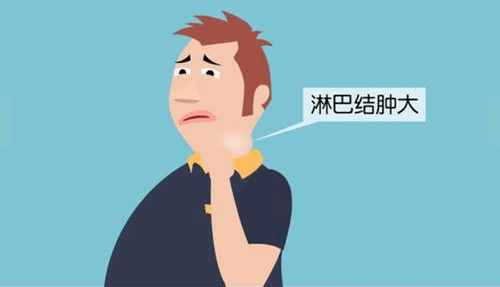 鼻咽癌淋巴结肿大图片图片