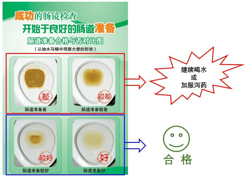 肠镜清水样便什么颜色图片