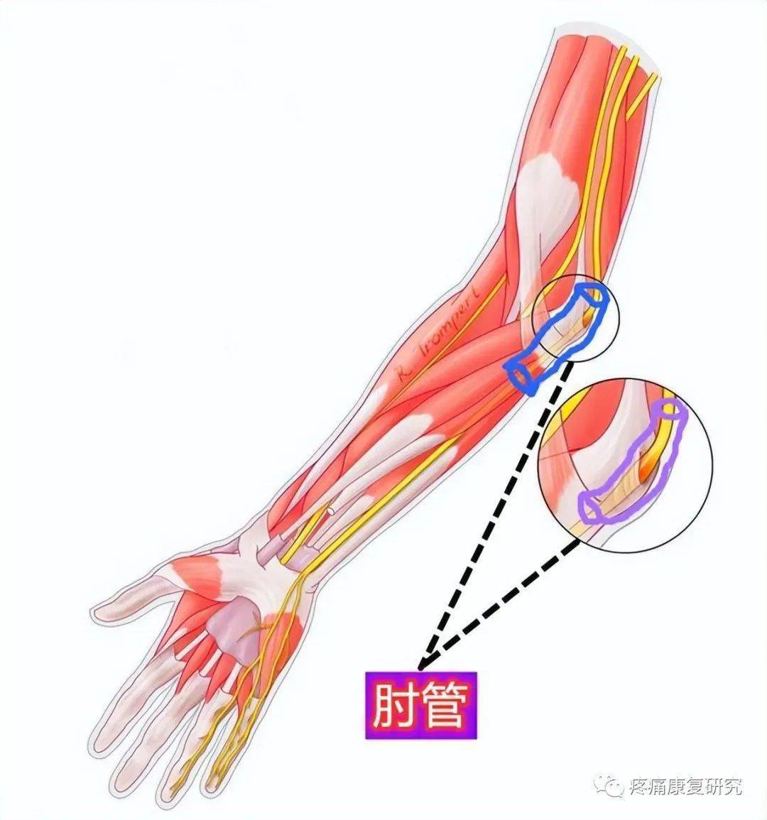 臂丛牵拉实验图片