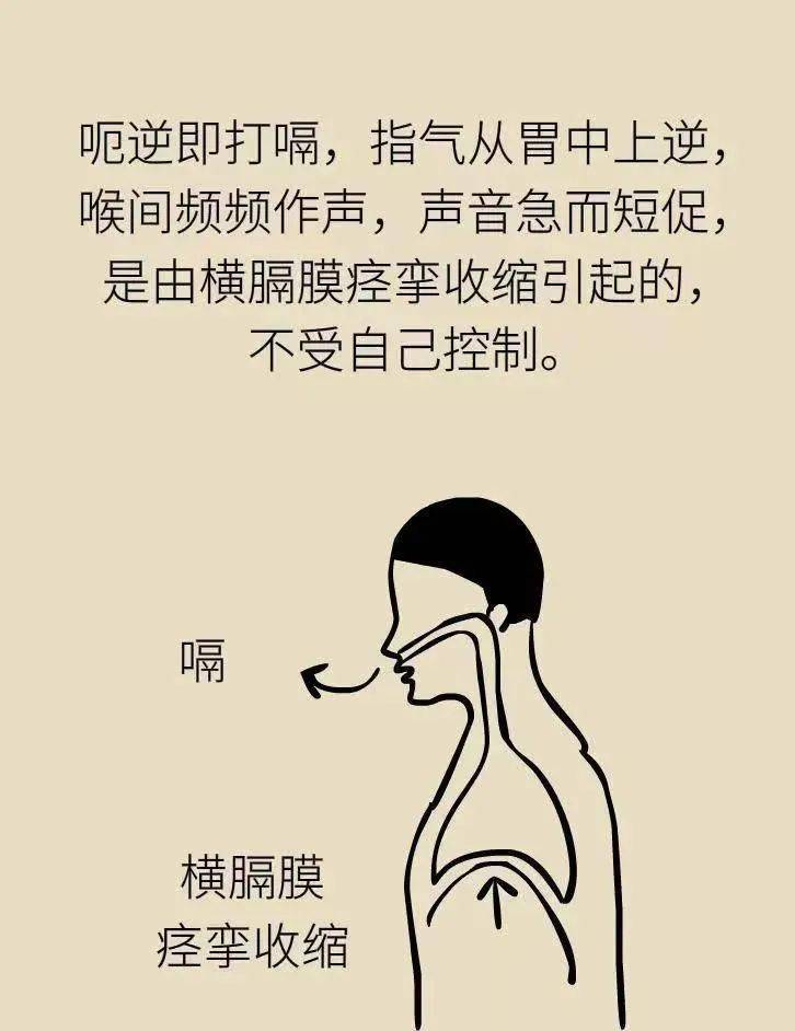 呃逆 来自搜狐网