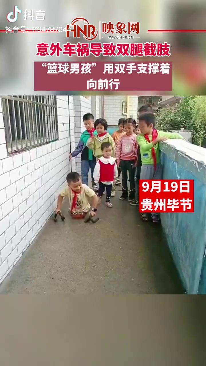 双腿截肢男孩图片