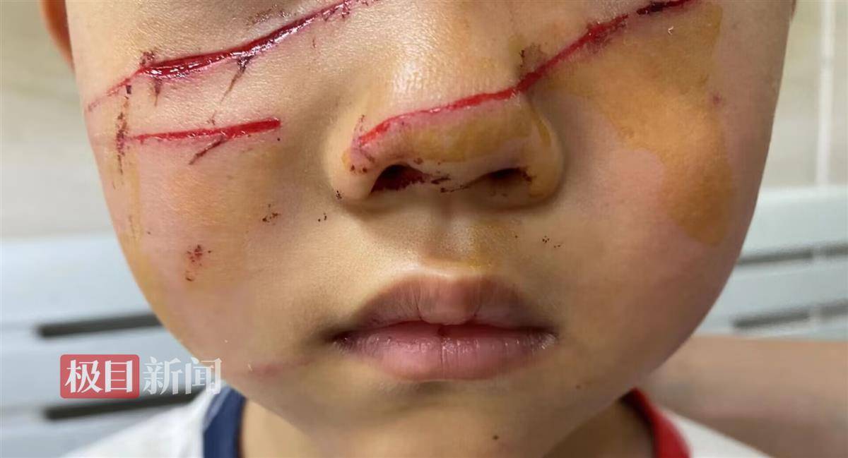 孩子游玩时被孔雀抓伤面部,露营基地:只能给予人道主义关怀