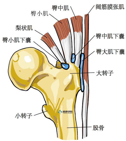 急性损伤常常由于大转子直接损伤或者髋关节手术引发的软的或者不平整