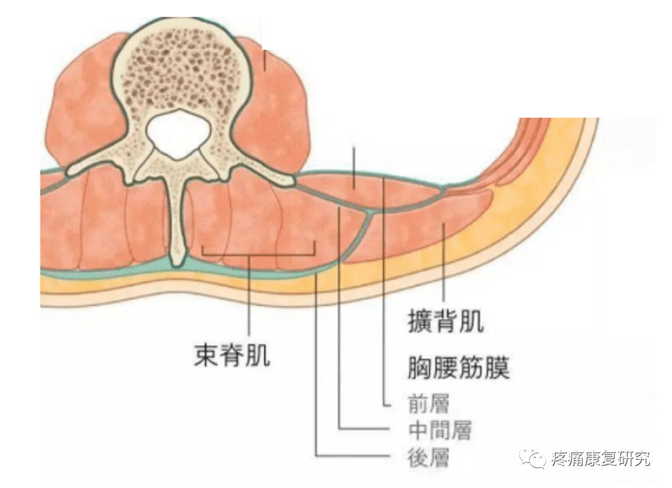 肌筋膜链失衡举例:背阔肌