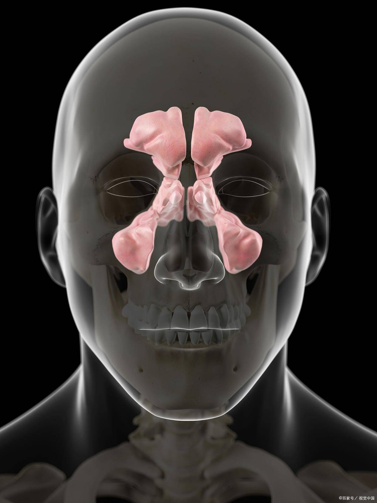 鼻窦炎可以治愈吗?不及时治疗会有哪些危害?_鼻腔_进行_炎症