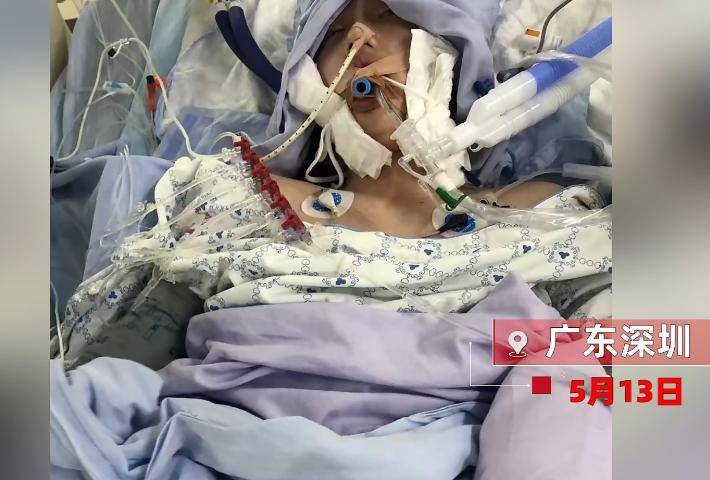 疑因楼下一住户违规用电,导致楼上16岁少女冲凉时触电,被送医抢救家长