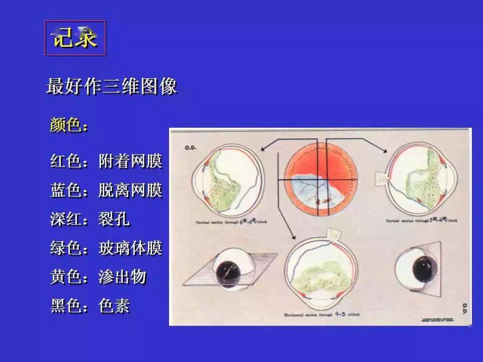 显微镜镜片凹凸顺序图片