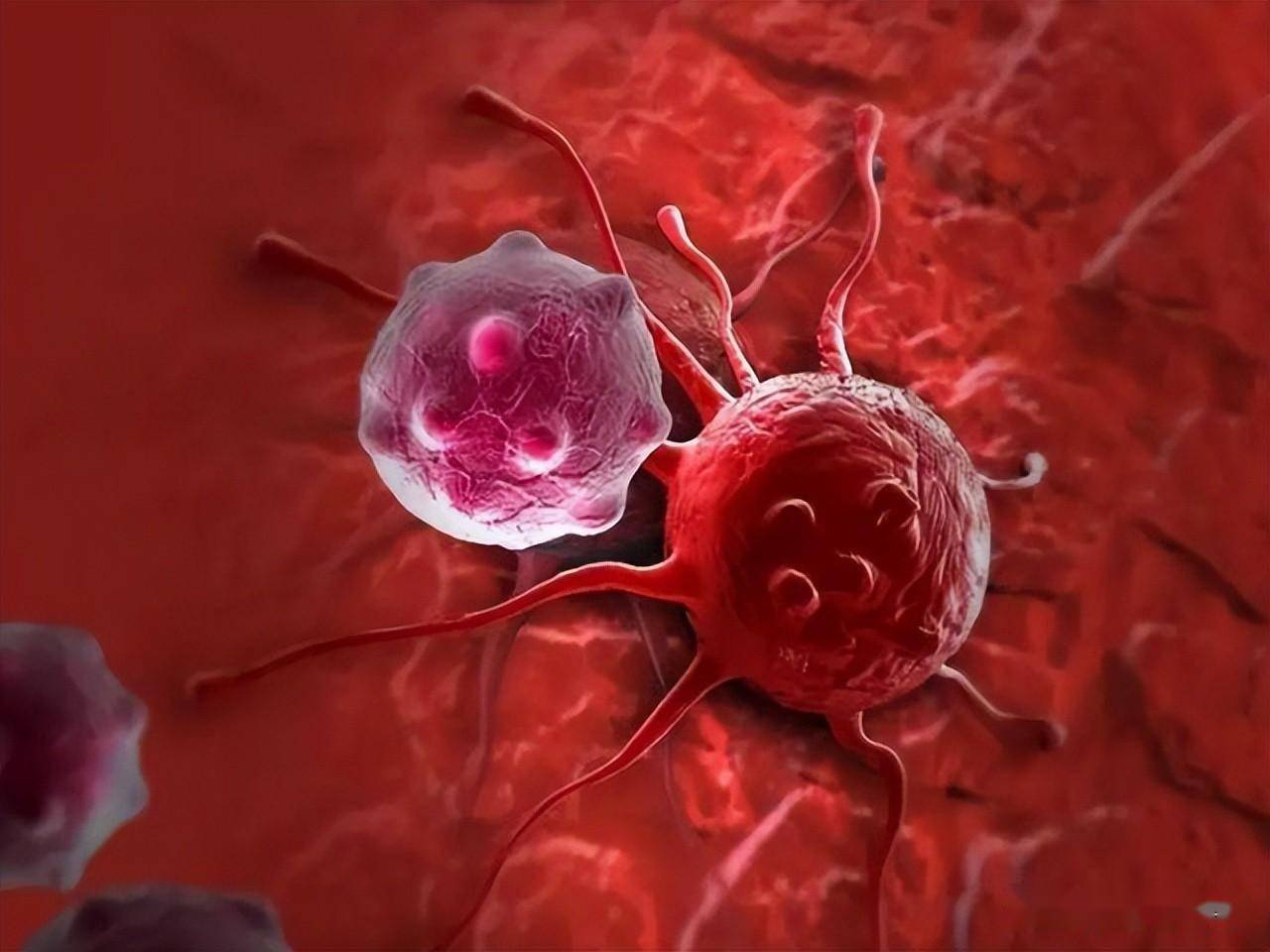 硼中子俘获治疗与质子重离子对比_疗法_抗癌_射线