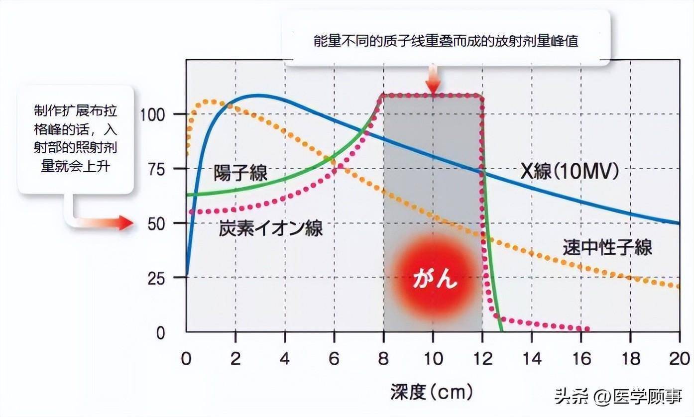 日本新一代抗癌技术：硼中子俘获疗法（BNCT）_治疗_细胞_癌症