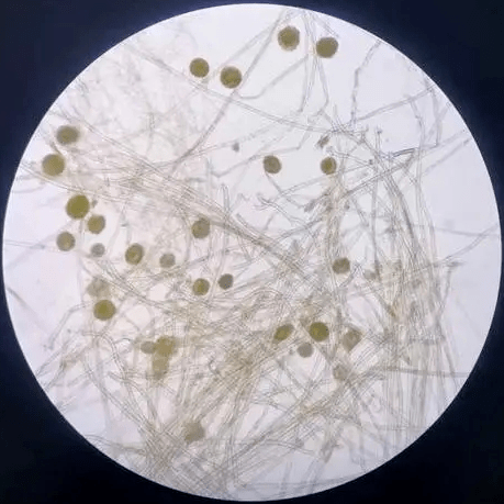 蜘蛛网状真菌菌落图片