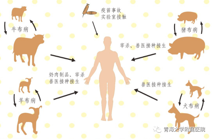 警惕!西安又有人确诊!_陕西省_布鲁氏菌_医生